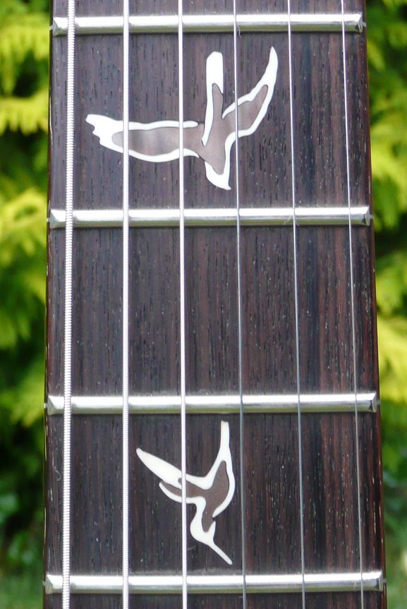 inlays.jpg